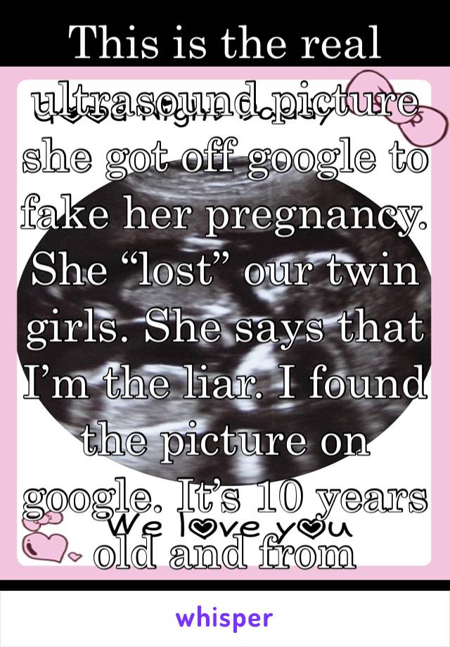 This is the real ultrasound picture she got off google to fake her pregnancy. She “lost” our twin girls. She says that I’m the liar. I found the picture on google. It’s 10 years old and from Europe.