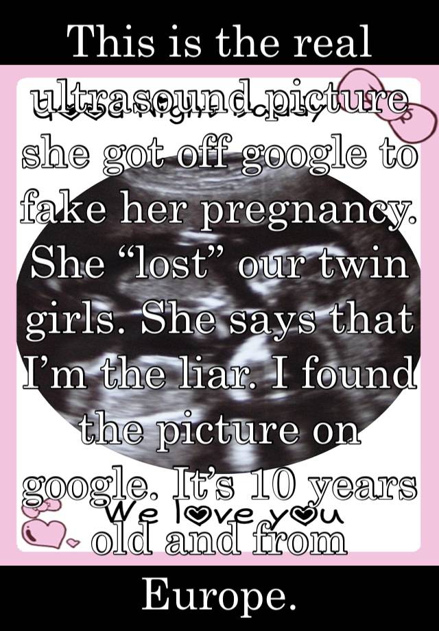 This is the real ultrasound picture she got off google to fake her pregnancy. She “lost” our twin girls. She says that I’m the liar. I found the picture on google. It’s 10 years old and from Europe.