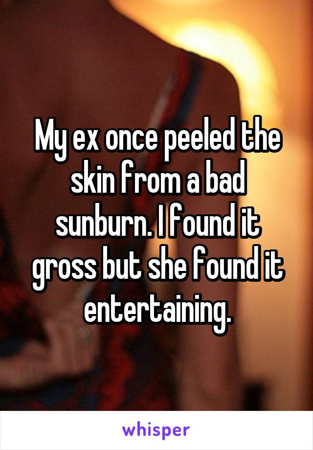 My ex once peeled the skin from a bad sunburn. I found it gross but she found it entertaining.