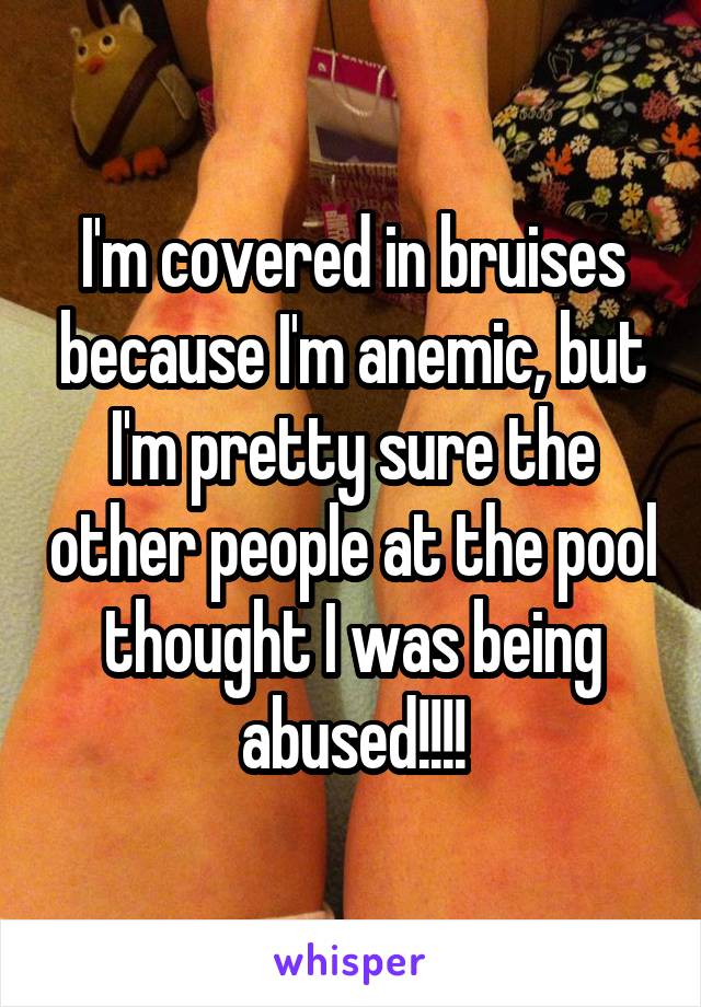 I'm covered in bruises because I'm anemic, but I'm pretty sure the other people at the pool thought I was being abused!!!!