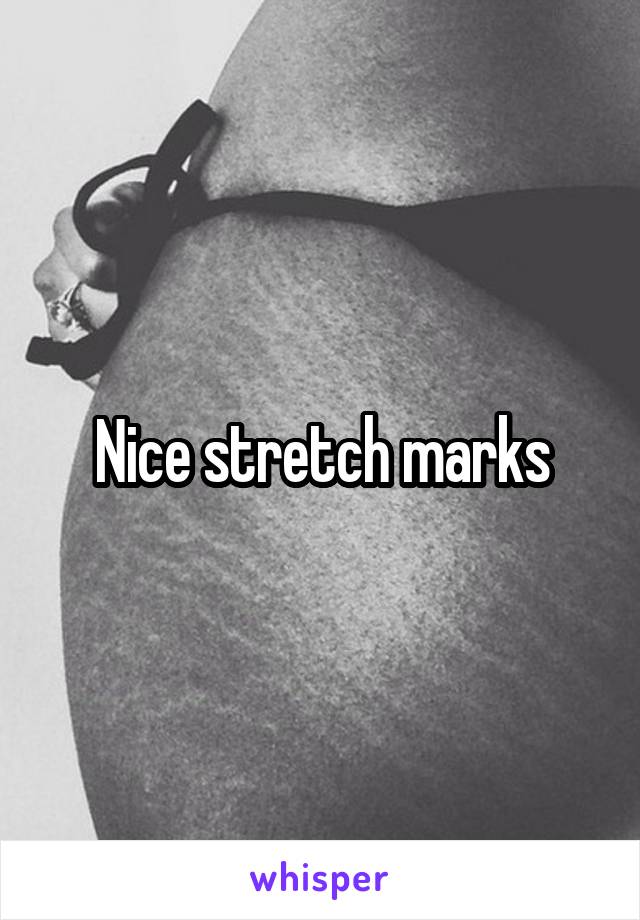 Nice stretch marks