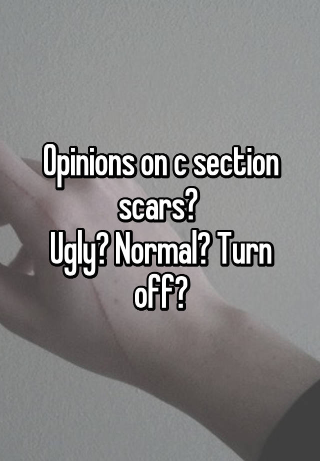 Opinions on c section scars? 
Ugly? Normal? Turn off?