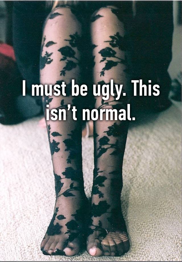 I must be ugly. This isn’t normal. 