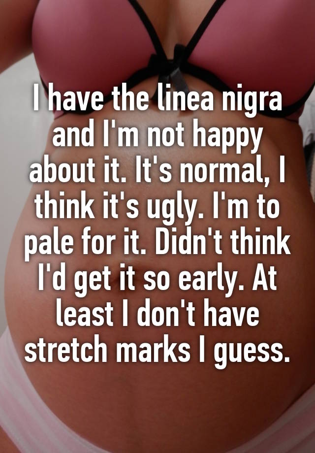 I have the linea nigra and I'm not happy about it. It's normal, I think it's ugly. I'm to pale for it. Didn't think I'd get it so early. At least I don't have stretch marks I guess.