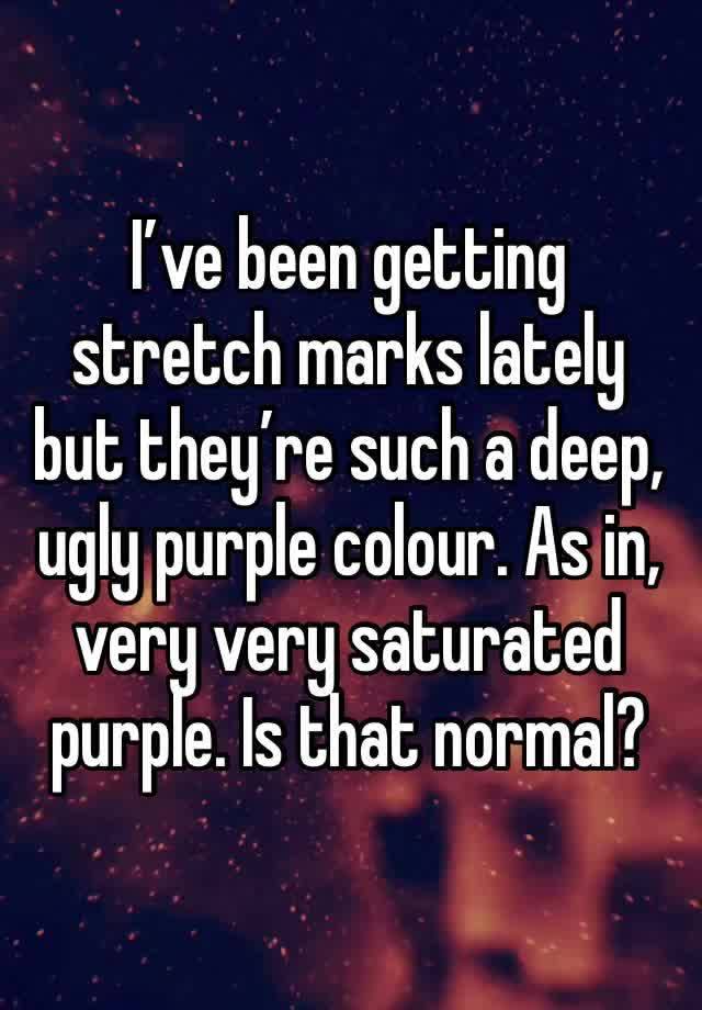 I’ve been getting stretch marks lately but they’re such a deep, ugly purple colour. As in, very very saturated purple. Is that normal?