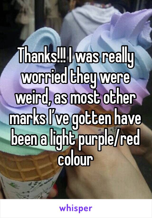 Thanks!!! I was really worried they were weird, as most other marks I’ve gotten have been a light purple/red colour