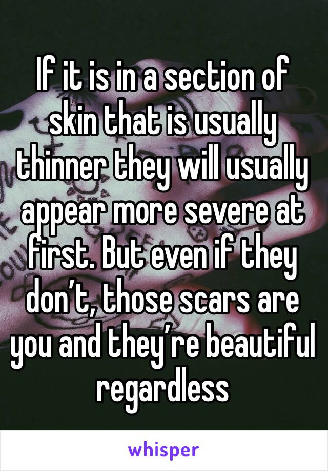 If it is in a section of skin that is usually thinner they will usually appear more severe at first. But even if they don’t, those scars are you and they’re beautiful regardless 