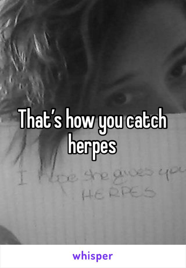 That’s how you catch herpes 