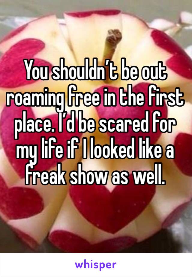 You shouldn’t be out roaming free in the first place. I’d be scared for my life if I looked like a freak show as well.
