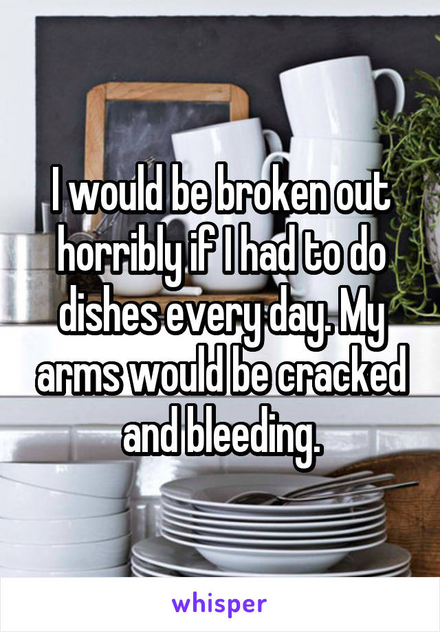 I would be broken out horribly if I had to do dishes every day. My arms would be cracked and bleeding.