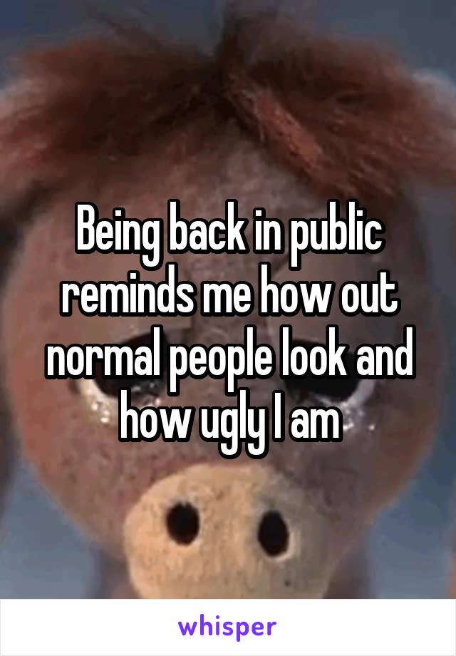 Being back in public reminds me how out normal people look and how ugly I am