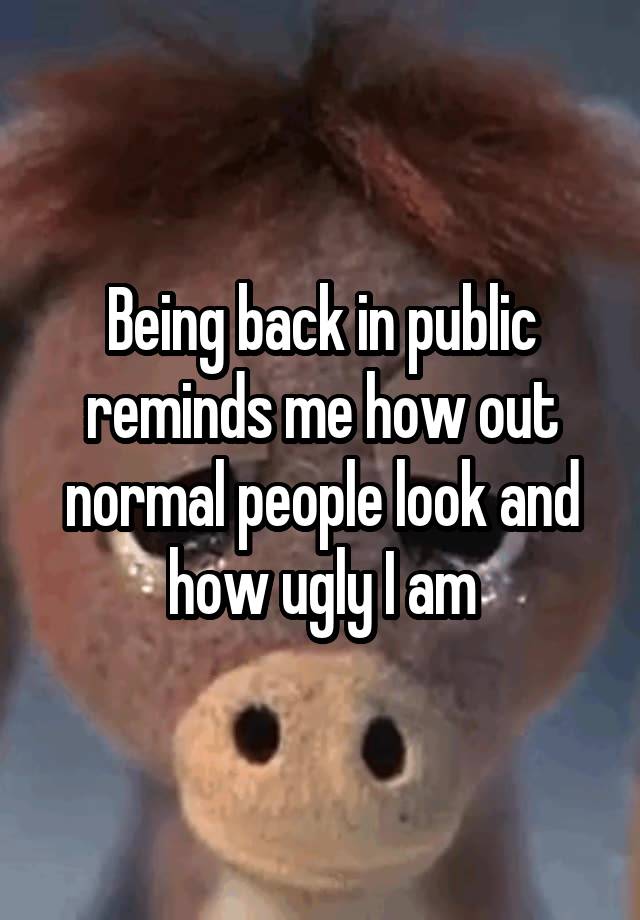 Being back in public reminds me how out normal people look and how ugly I am