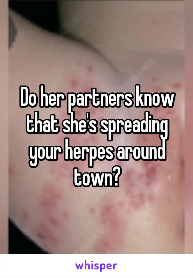 Do her partners know that she's spreading your herpes around town?