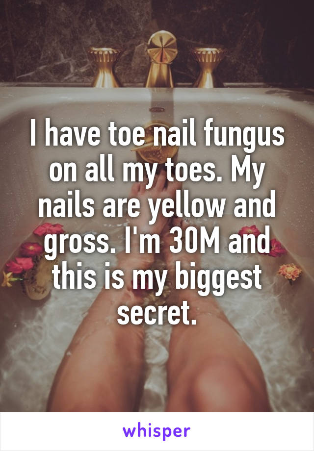 I have toe nail fungus on all my toes. My nails are yellow and gross. I'm 30M and this is my biggest secret.