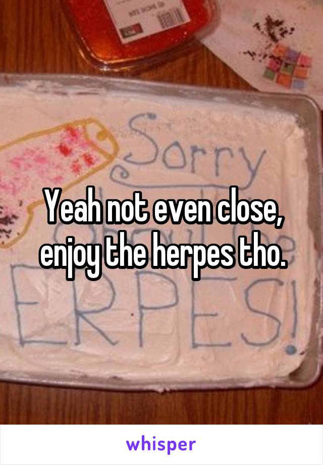 Yeah not even close, enjoy the herpes tho.