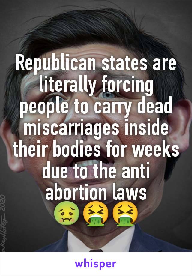 Republican states are literally forcing people to carry dead miscarriages inside their bodies for weeks due to the anti abortion laws
🤢🤮🤮