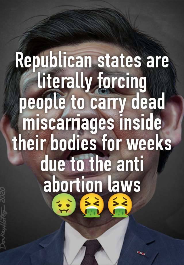 Republican states are literally forcing people to carry dead miscarriages inside their bodies for weeks due to the anti abortion laws
🤢🤮🤮