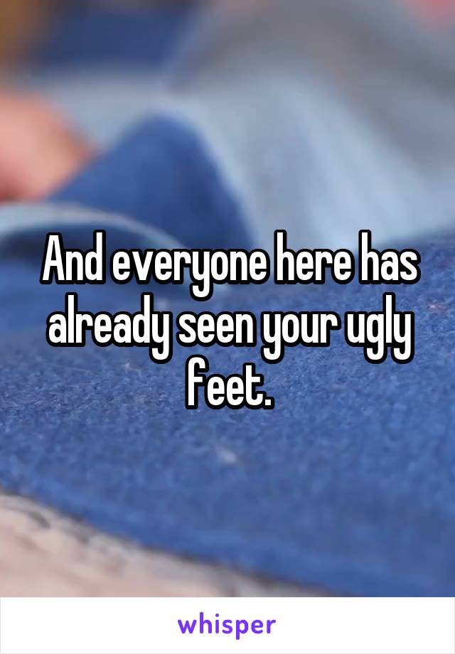 And everyone here has already seen your ugly feet.