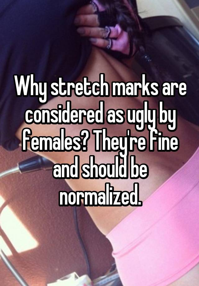 Why stretch marks are considered as ugly by females? They're fine and should be normalized.