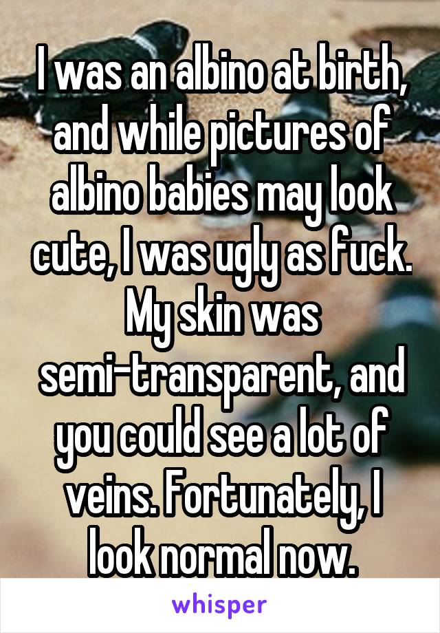 I was an albino at birth, and while pictures of albino babies may look cute, I was ugly as fuck. My skin was semi-transparent, and you could see a lot of veins. Fortunately, I look normal now.