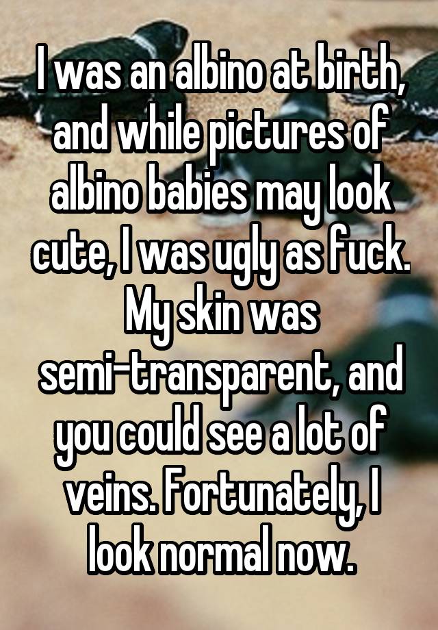 I was an albino at birth, and while pictures of albino babies may look cute, I was ugly as fuck. My skin was semi-transparent, and you could see a lot of veins. Fortunately, I look normal now.