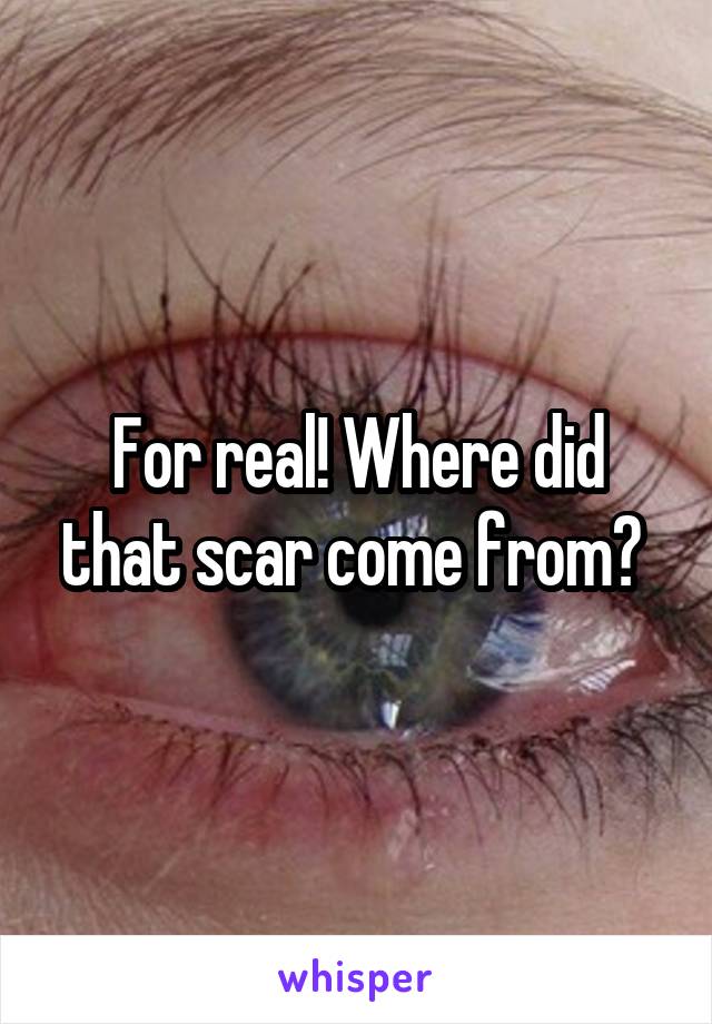 For real! Where did that scar come from? 