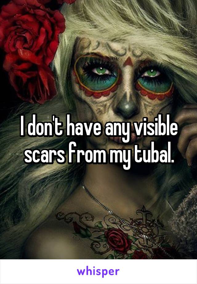 I don't have any visible scars from my tubal.