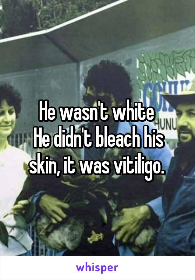 He wasn't white 
He didn't bleach his skin, it was vitiligo. 