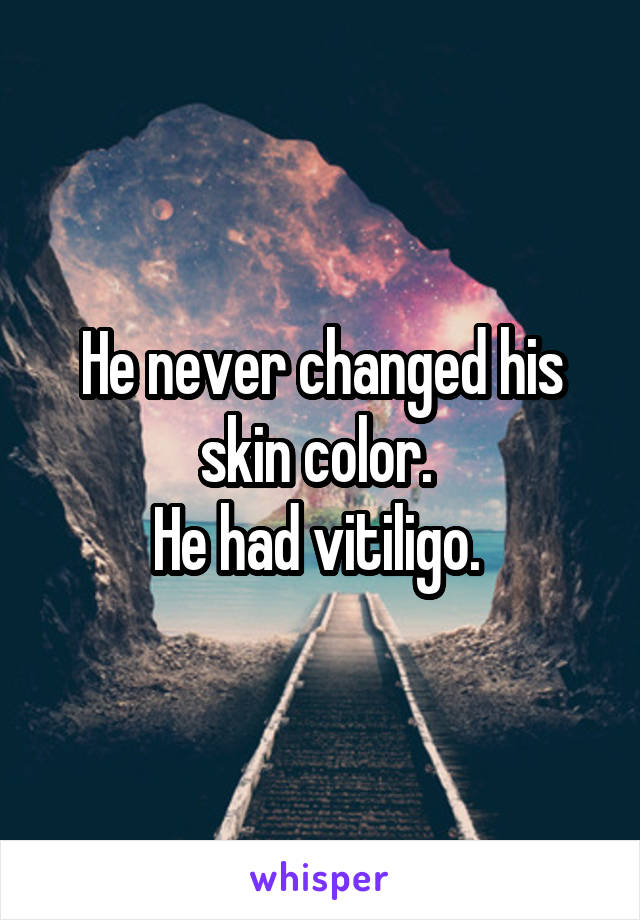 He never changed his skin color. 
He had vitiligo. 