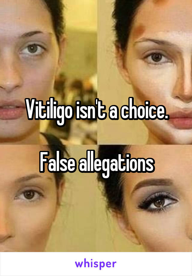 Vitiligo isn't a choice.

False allegations