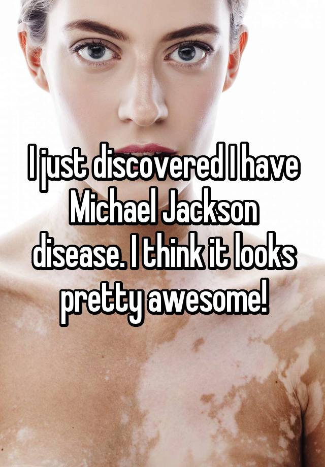 I just discovered I have Michael Jackson disease. I think it looks pretty awesome!