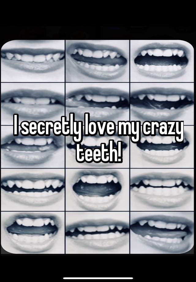 I secretly love my crazy teeth!