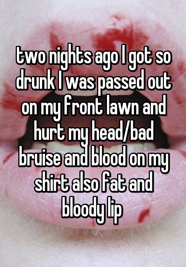 two nights ago I got so drunk I was passed out on my front lawn and hurt my head/bad bruise and blood on my shirt also fat and bloody lip 