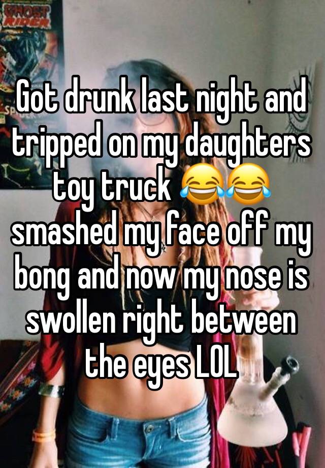 Got drunk last night and tripped on my daughters toy truck 😂😂 smashed my face off my bong and now my nose is swollen right between the eyes LOL