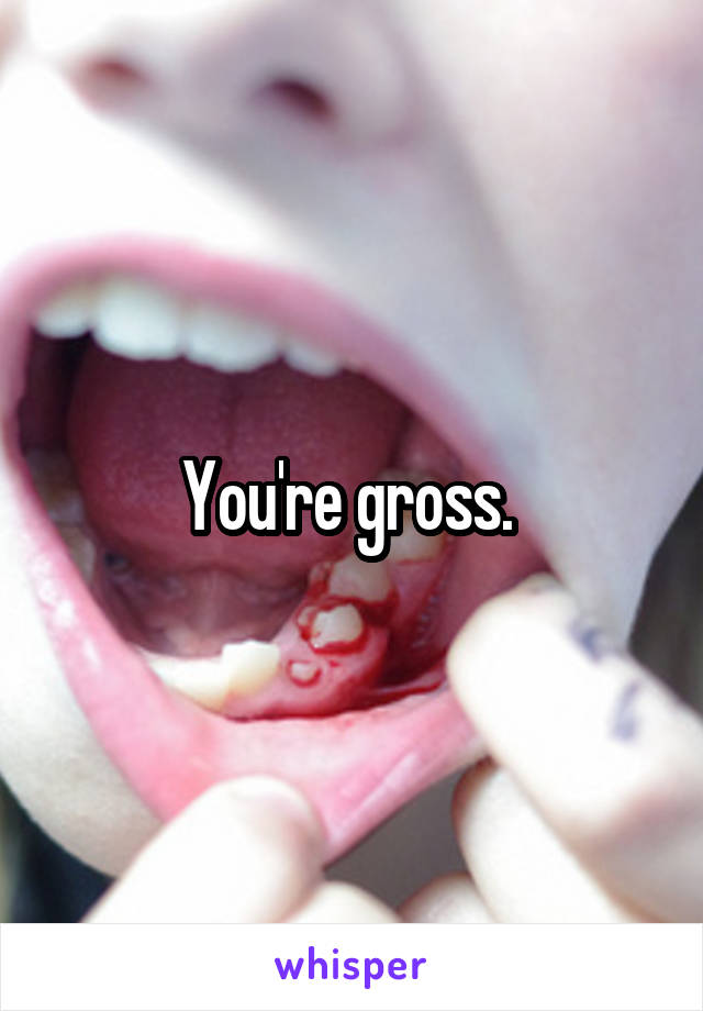 You're gross. 