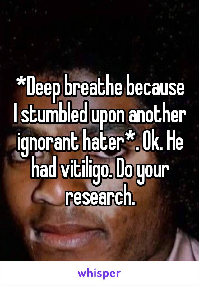 *Deep breathe because I stumbled upon another ignorant hater*. Ok. He had vitiligo. Do your research.