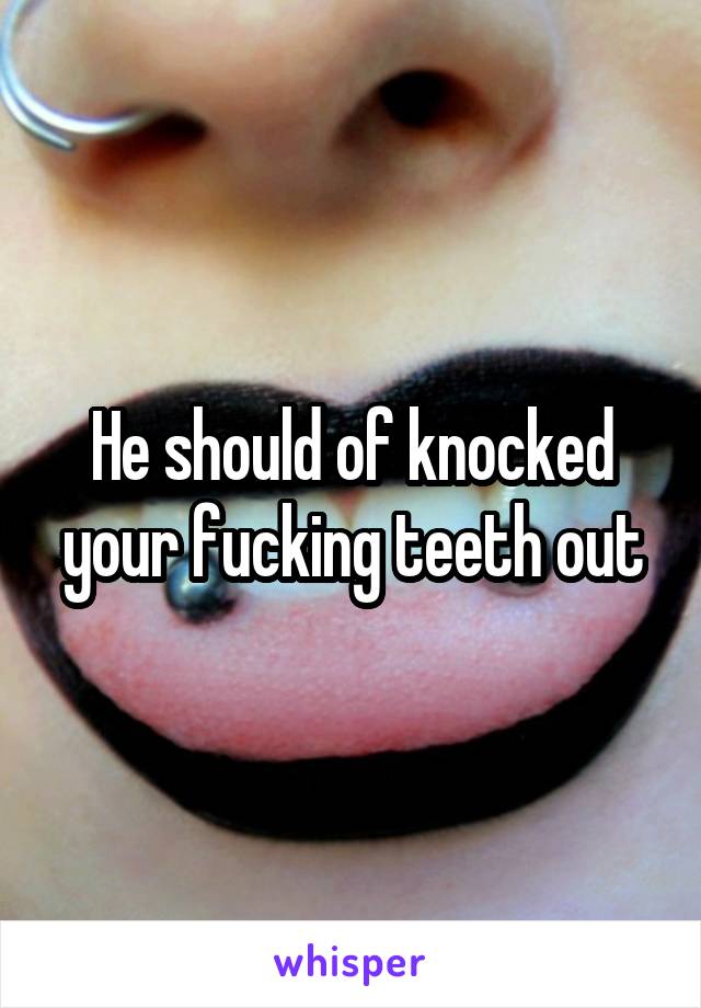 He should of knocked your fucking teeth out