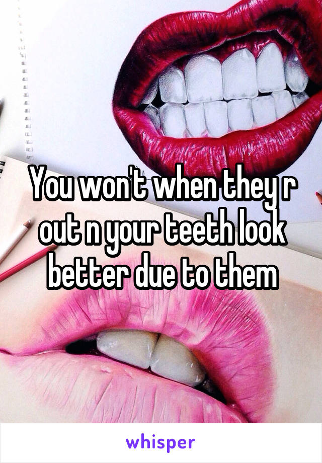 You won't when they r out n your teeth look better due to them