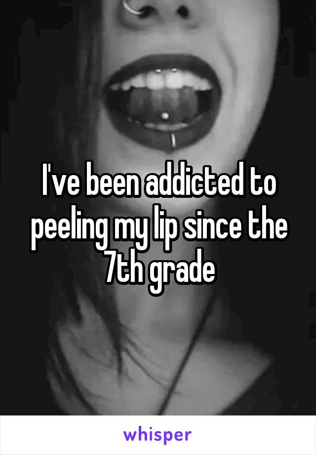 I've been addicted to peeling my lip since the 7th grade