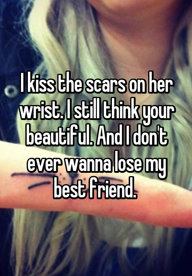 I kiss the scars on her wrist. I still think your beautiful. And I don't ever wanna lose my best friend. 