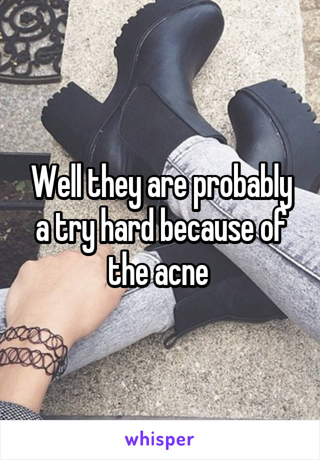 Well they are probably a try hard because of the acne 