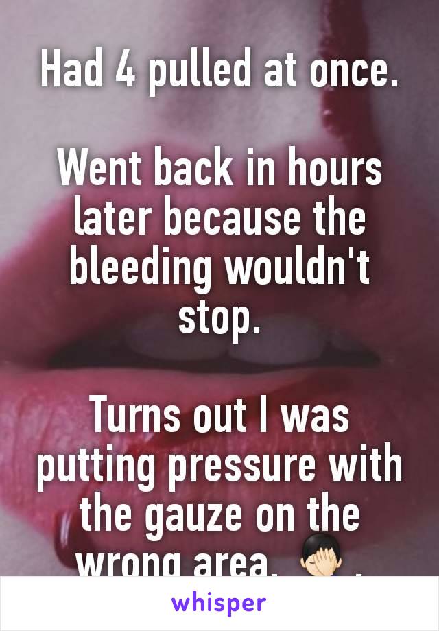 Had 4 pulled at once.

Went back in hours later because the bleeding wouldn't stop.

Turns out I was putting pressure with the gauze on the wrong area. 🤦🏻‍♂️.