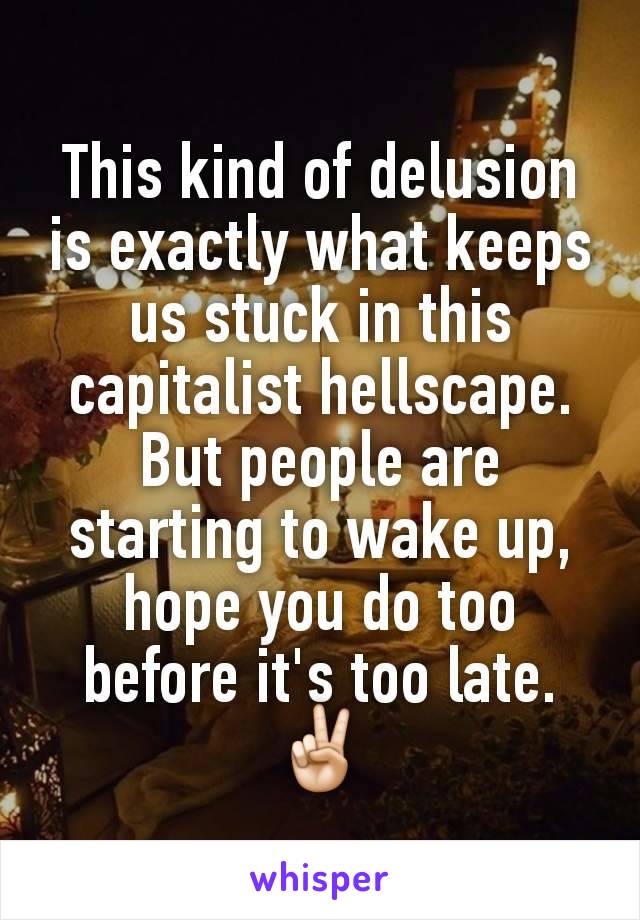 This kind of delusion is exactly what keeps us stuck in this capitalist hellscape. But people are starting to wake up, hope you do too before it's too late. ✌🏻