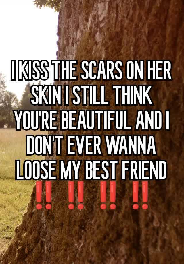 I KISS THE SCARS ON HER SKIN I STILL THINK YOU'RE BEAUTIFUL AND I DON'T EVER WANNA LOOSE MY BEST FRIEND ‼️‼️‼️‼️