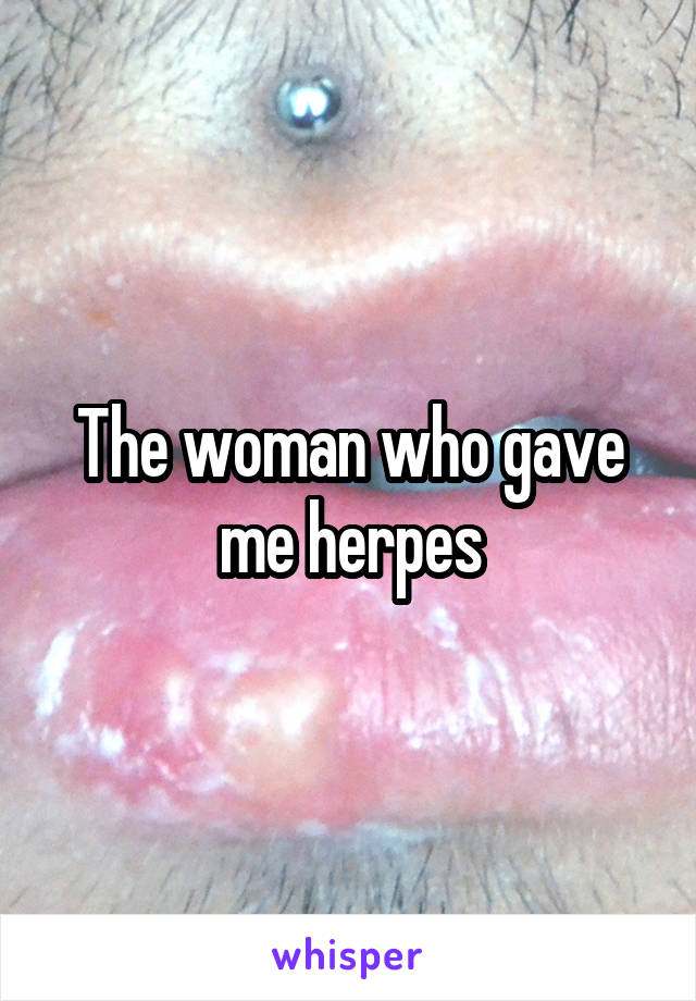 The woman who gave me herpes