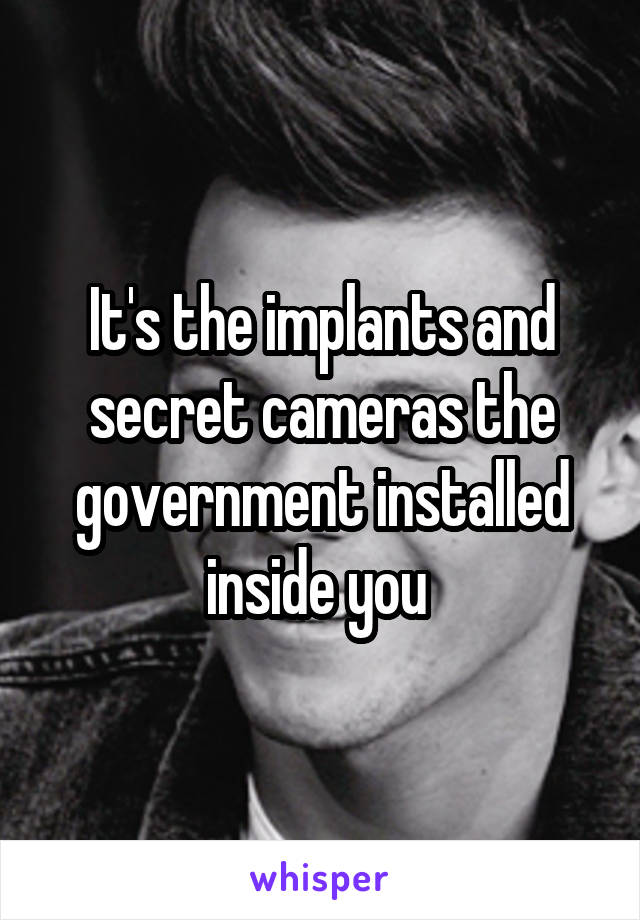 It's the implants and secret cameras the government installed inside you 