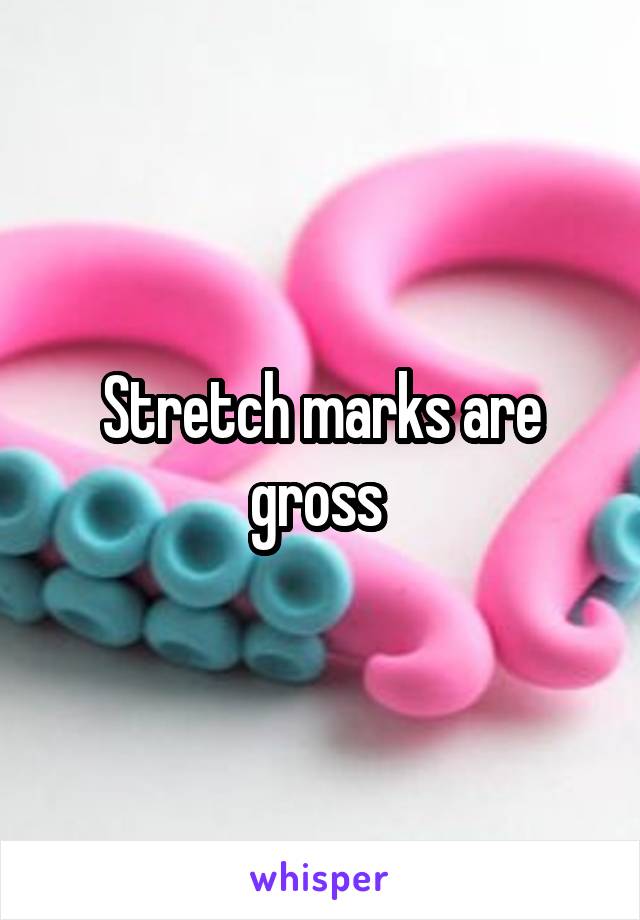 Stretch marks are gross 