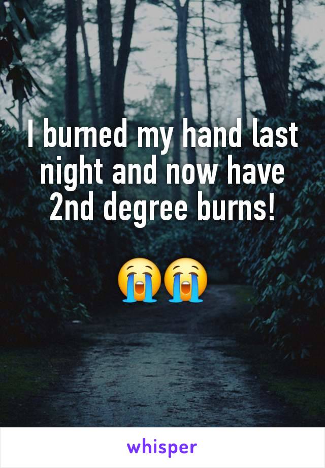 I burned my hand last night and now have 2nd degree burns!

😭😭