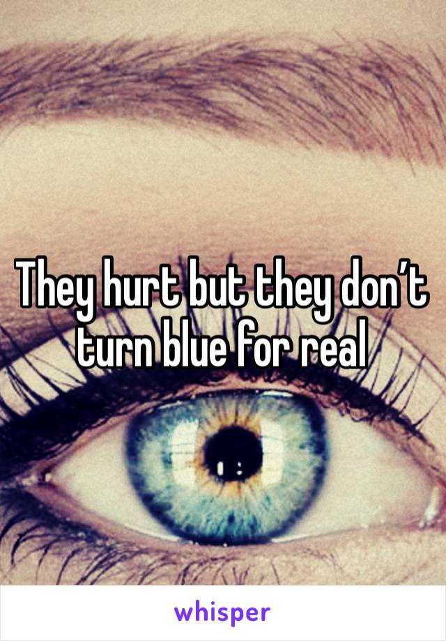 They hurt but they don’t turn blue for real 