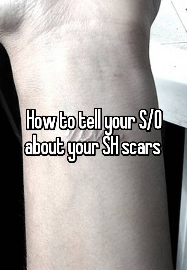 How to tell your S/O about your SH scars 